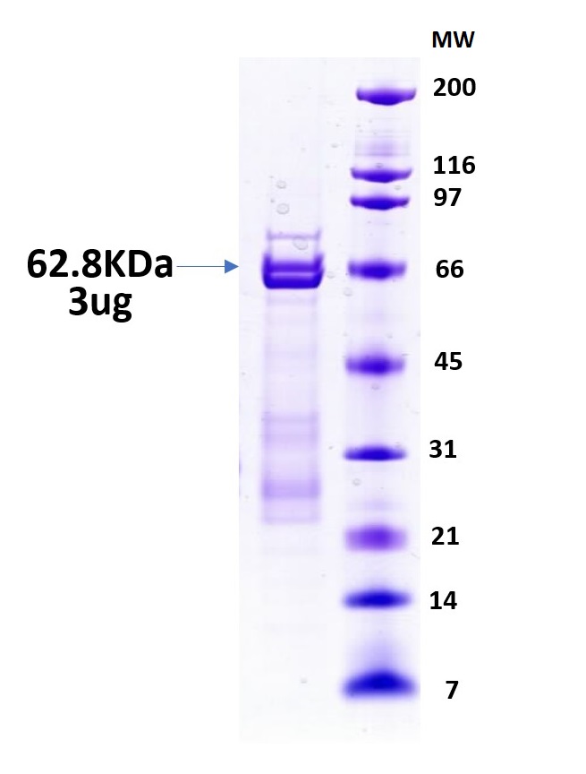 SDS-PAGE - Recombinant Human SP1 protein (Tagged) (AB81801)