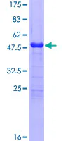 SDS-PAGE - Recombinant Human SP17 protein (GST tag N-Terminus) (AB162682)