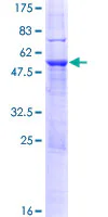 SDS-PAGE - Recombinant Human SP2 transcription factor protein (GST tag N-Terminus) (AB117031)