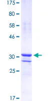 SDS-PAGE - Recombinant Human Sp7 / Osterix protein (GST tag N-Terminus) (AB153589)