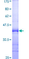 SDS-PAGE - Recombinant Human Spa-1 protein (GST tag N-Terminus) (AB159512)