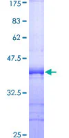 SDS-PAGE - Recombinant Human Spa-1 protein (GST tag N-Terminus) (AB159512)