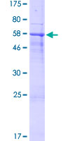Recombinant Human SPACA1 protein
