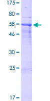 SDS-PAGE - Recombinant Human SPACA1 protein (GST tag N-Terminus) (AB164368)