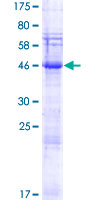 SDS-PAGE - Recombinant Human SPACA3 protein (AB165225), expandable thumbnail