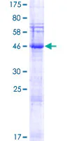 SDS-PAGE - Recombinant Human SPACA3 protein (AB165225)