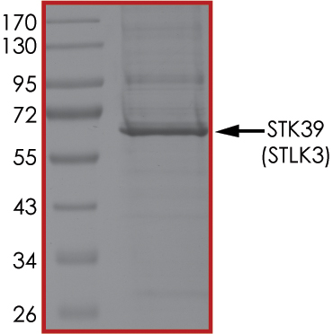 Recombinant human SPAK protein
