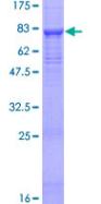 Recombinant Human SPAM1 protein