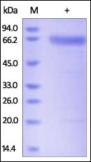 SDS-PAGE - Recombinant human SPAM1 protein (AB174000), expandable thumbnail