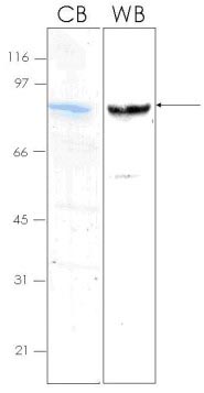 Recombinant Human SPARC protein