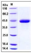 SDS-PAGE - Recombinant Human SPARC protein (His tag) (AB276339), expandable thumbnail