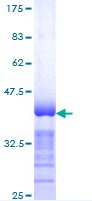 SDS-PAGE - Recombinant Human Spastin protein (AB152700), expandable thumbnail