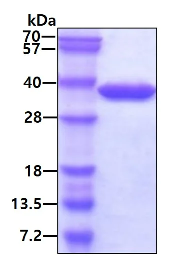SDS-PAGE - Recombinant Human Spermidine synthase protein (His tag N-Terminus) (AB101051)