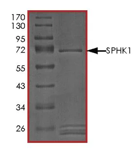 SDS-PAGE - Recombinant human SPHK1 protein (Active) (AB268978)