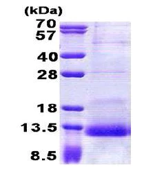 SDS-PAGE - Recombinant Human SPINK1/P12 protein (His tag N-Terminus) (AB168878)