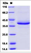 SDS-PAGE - Recombinant Human SPINK2 protein (Fc Chimera) (AB276569)