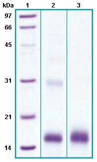 SDS-PAGE - Recombinant Human sPLA2-X protein (His tag) (AB63847), expandable thumbnail