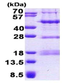 SDS-PAGE - Recombinant Human SPOC1 protein (AB167864)