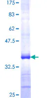SDS-PAGE - Recombinant Human SPOCK3 protein (GST tag N-Terminus) (AB162373)