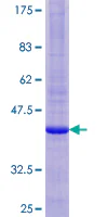 SDS-PAGE - Recombinant Human SPP protein (GST tag N-Terminus) (AB153530)