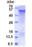 SDS-PAGE - Recombinant Human SPRED1 protein (denatured) (His tag N-Terminus) (AB187437)