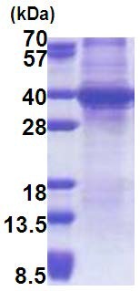 SDS-PAGE - Recombinant Human Sprouty 4/Spry-4 protein (denatured) (AB171684), expandable thumbnail