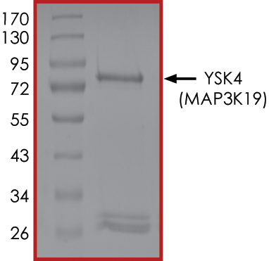 Recombinant human Sps1/Ste20 related kinase 4 protein