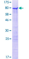SDS-PAGE - Recombinant Human SPS2L/SPATS2L protein (AB161869)