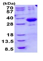 SDS-PAGE - Recombinant Human SPSB2 protein (His tag N-Terminus) (AB134592)