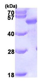 SDS-PAGE - Recombinant Human SQSTM1 / p62 protein (AB95320)