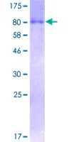 SDS-PAGE - Recombinant Human SQSTM1 / p62 protein (GST tag N-Terminus) (AB132366)