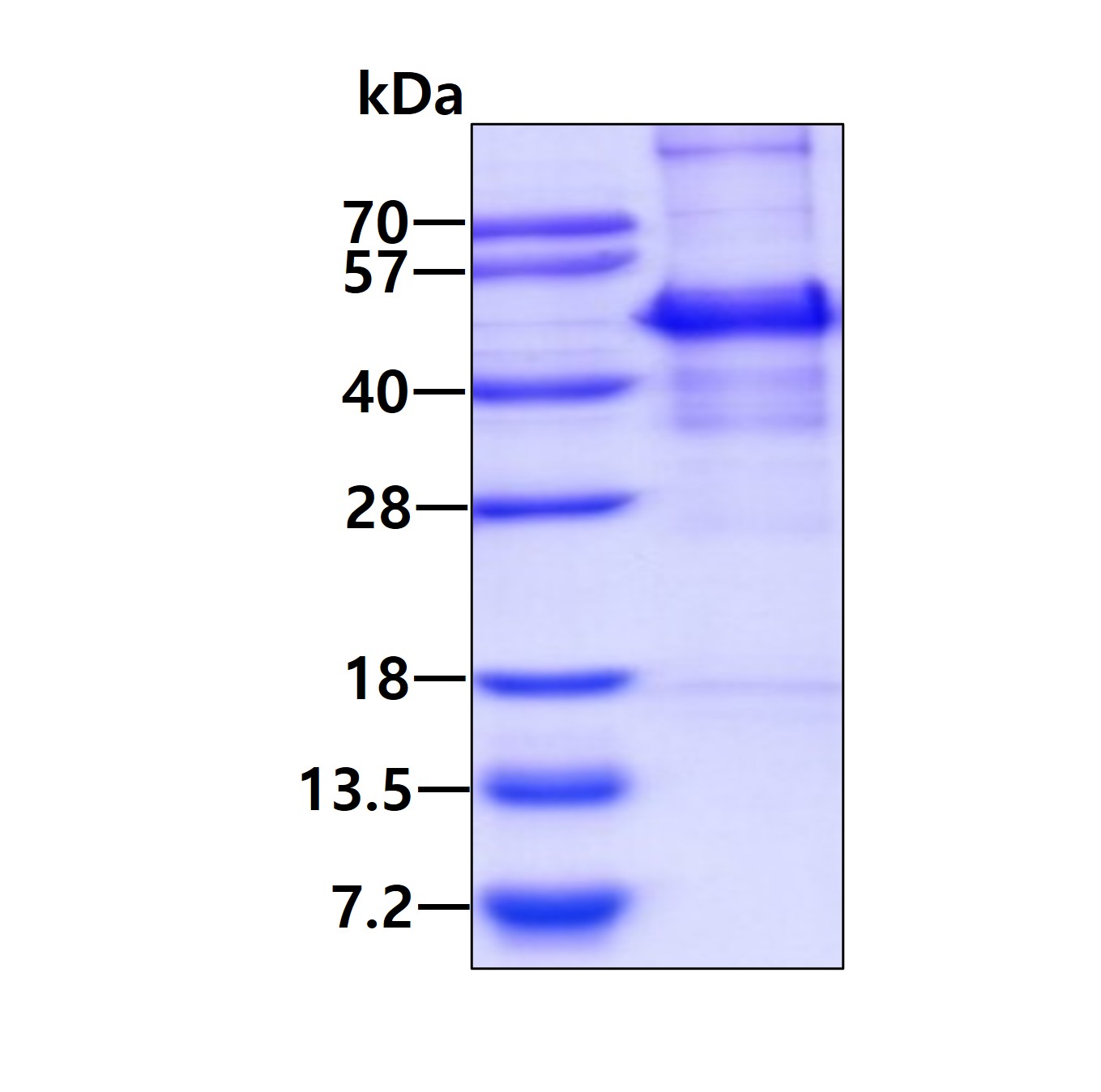 SDS-PAGE - Recombinant Human SQSTM1 / p62 protein (His tag C-Terminus) (AB95320)