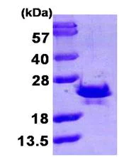 SDS-PAGE - Recombinant Human SR1 protein (His tag N-Terminus) (AB104927)