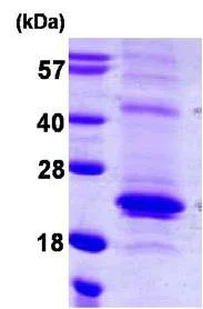 SDS-PAGE - Recombinant Human sRANKL protein (His tag N-Terminus) (AB108129)