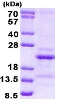 SDS-PAGE - Recombinant Human SRAP protein (AB137163), expandable thumbnail