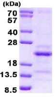 SDS-PAGE - Recombinant Human SRAP protein (His tag N-Terminus) (AB137163)