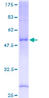 SDS-PAGE - Recombinant Human SRD5A1 protein (AB116886), expandable thumbnail