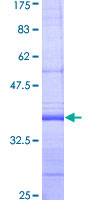 SDS-PAGE - Recombinant Human SREBP1 protein (GST tag N-Terminus) (AB159577)