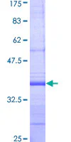 SDS-PAGE - Recombinant Human SREBP1 protein (GST tag N-Terminus) (AB159577)