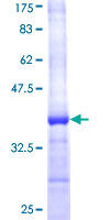 SDS-PAGE - Recombinant Human SREBP2 protein (AB114215)