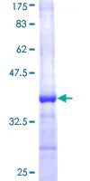 SDS-PAGE - Recombinant Human SREBP2 protein (GST tag N-Terminus) (AB114215)