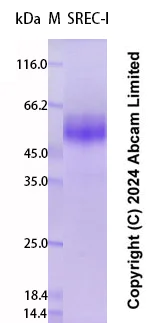 SDS-PAGE - Recombinant Human SREC-I Protein Standard (His tag) (AB323022)
