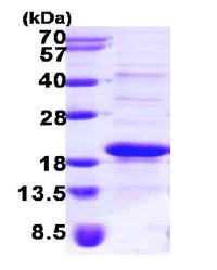SDS-PAGE - Recombinant Human SRP14 protein (His tag N-Terminus) (AB101206)