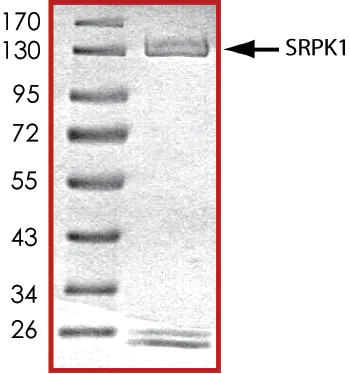 SDS-PAGE - Recombinant human SRPK1 protein (AB85295)