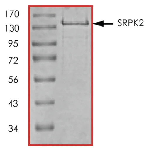 SDS-PAGE - Recombinant human SRPK2 protein (AB85293)