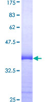 SDS-PAGE - Recombinant Human SRSF10 protein (AB161147)