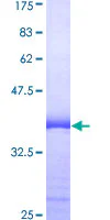 SDS-PAGE - Recombinant Human SRSF10 protein (GST tag N-Terminus) (AB161147)
