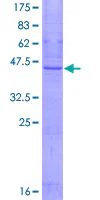 SDS-PAGE - Recombinant Human SSPN protein (GST tag N-Terminus) (AB159942)