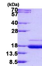 SDS-PAGE - Recombinant Human SSR2 protein (AB140550)