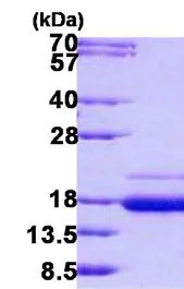 SDS-PAGE - Recombinant Human SSR2 protein (His tag N-Terminus) (AB140550)